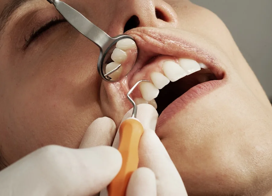 Diş Dolgusu için dental uygulamayı temsil eden görsel