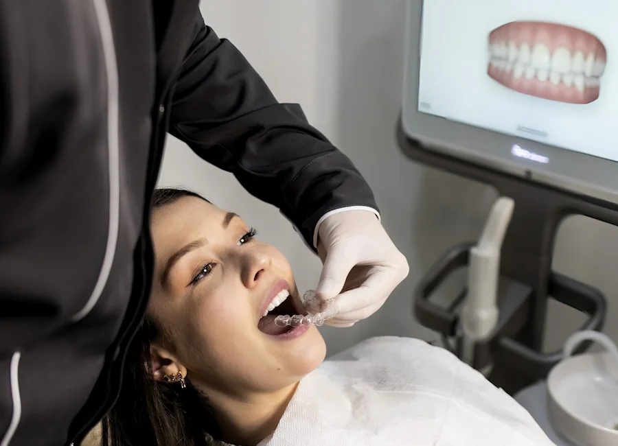 Estetik Bonding için dental uygulamayı temsil eden görsel