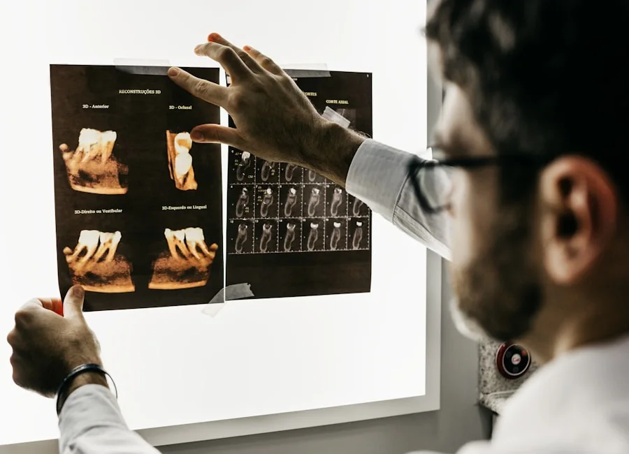 Diş hekimi tarafından incelenen ayrıntılı dental röntgen görüntüleri